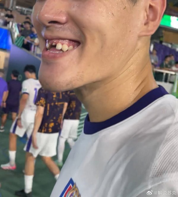 记者：王献均门牙留在了黄龙体育中心，许多东说念主一都找都没找到
